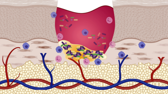 Graphic displaying how wounds heal