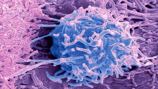 Microscopic image of a cancer cell.
